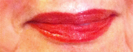 after-lip